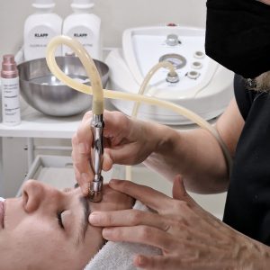 Tratamiento facial de dermoabrasión con punta de diamante en Gijón