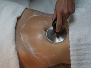 Tratamiento de Indiba corporal en Gijón