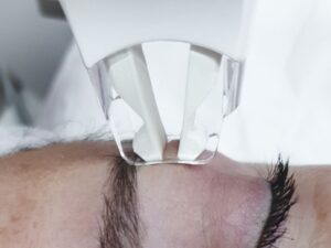 LPG facial en Gijón